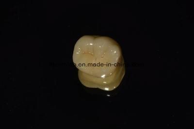 Bruxzir Solid Stable Zirconia Bridge From China Dental Lab