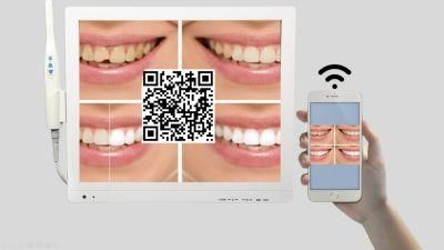 Scan Qr Take Pictures Dental Camera