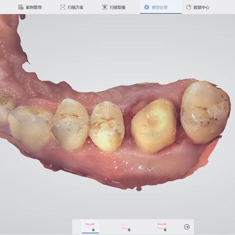 Cheap Price Panda P2 3D Dental Digital Intraoral Scanner