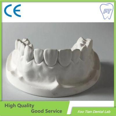 Promotional Orthodontics Study Model Removable Denture