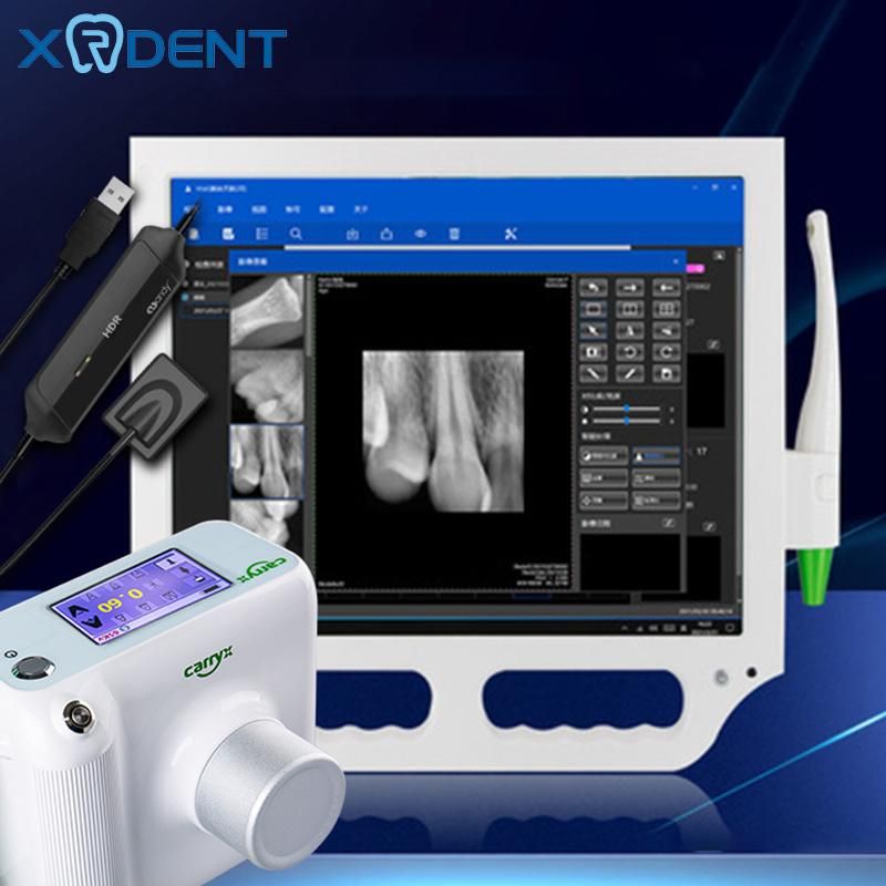 17 Inch Touch Screen Dental Oral Camera with Monitor