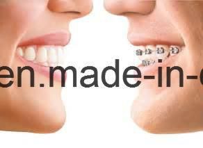 Invisible Orthodontic Trays Made in China Dental Lab From Shenzhen China Which Can Align Your Uneven Teeth