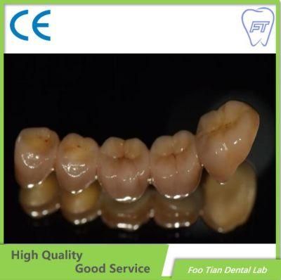 Professional Services Zirconia Crown and Bridge Made From China Dental Lab