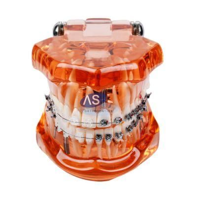 Dental Orthodontic Self-Ligating Mini Bracket Mbt Roth 022&quot; 345 Hooks