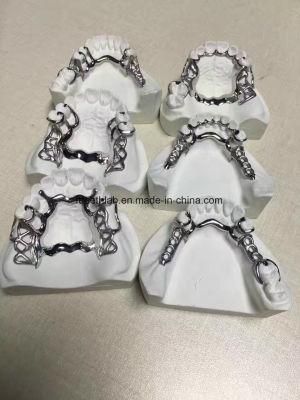 Vitallium 2000 Cast Metal Partial Denture