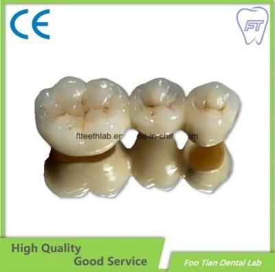 Implant Bridge Dental Lab Zirconia Crown and Bridge Made From China