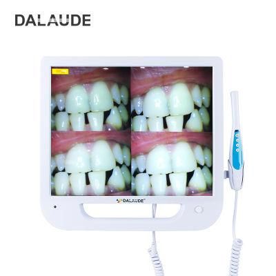 17inch LCD Monitor 10 Megapixels High Definition Dental Digital Viewer Intraoral Camera VGA Connection Endoscrope with Multimedia