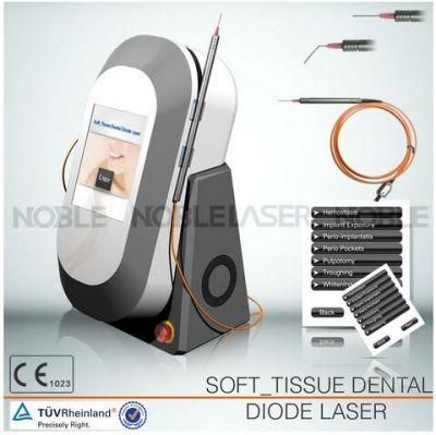 Dental Soft Tissue Laser for Teeth Whitening