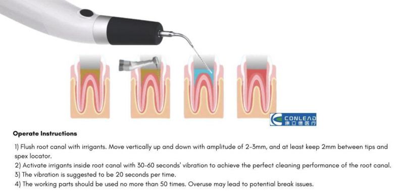 Newest Cordless Ultrasonic Activator