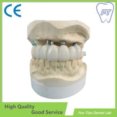 Dental Implant Aesthetic Dental Zirconium Bridges From China Dental Lab