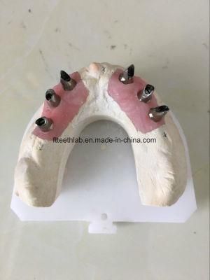 Customized Abutment for Dental Implants Made in China Dental Lab