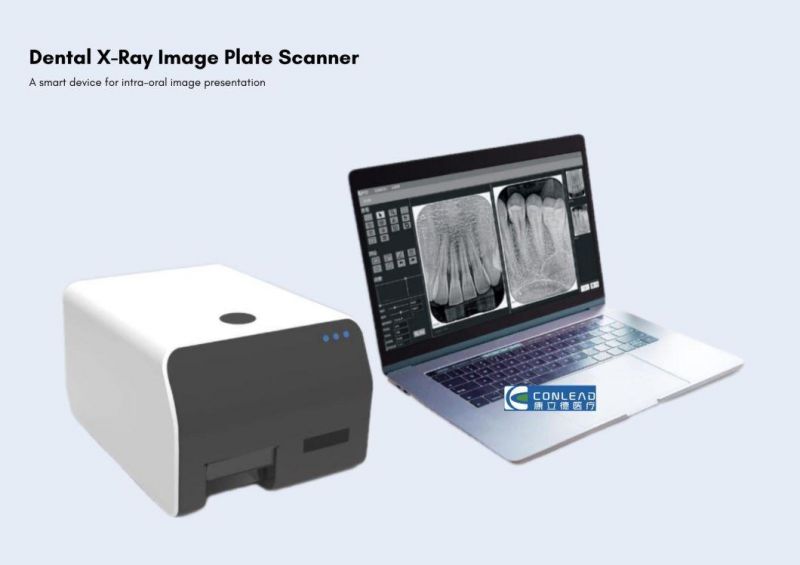 New Dental X-ray Film Reader Viewer Scanner Digital Image Converter