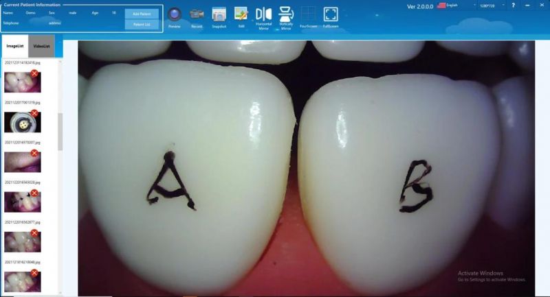 ISO13485 Factory Dental Apparatus Portable Digital Oral Camera USB Model