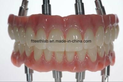 Dental Material Lab Implant Dental Lab Custom Dental Long Implant Bridge