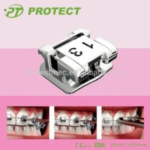 Protect Orthodontic Self Ligating Braces Dental Ortho