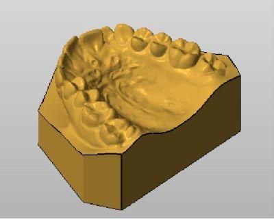 Dental CAD Design