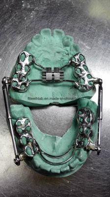 Dental Material Lab Implant Custom Orthodontic Herbst Occlusal Hinge Made in China Dental Lab