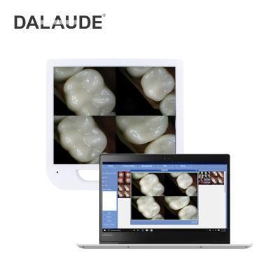 Factory Price and New Design Intraoral Camera with Monitor