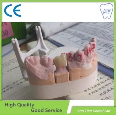 Manufacture Factory Bruxzir Solid Stable Zirconia Bridge From China Dental Lab on Selling