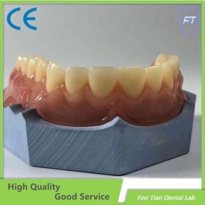 Factory Price Removable Denture Cobalt Chrome Casting Framework Customized