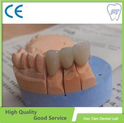 Professional Services Bruxzir Solid Stable Zirconia Bridge From China Dental Lab