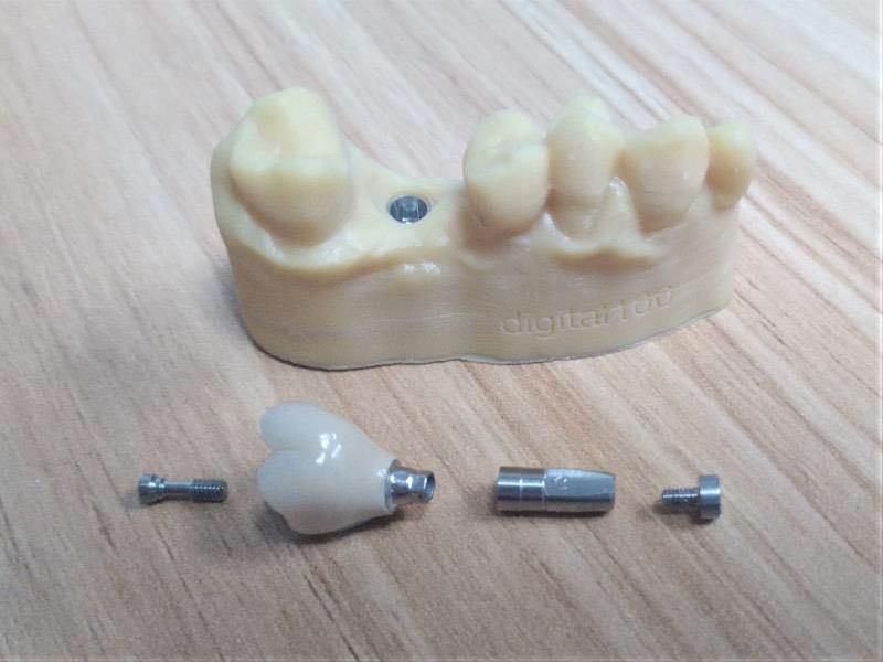 Digital Dental Implant Supplies Ceramiccrown Material Instrument Made From China Dental Lab Dental Implant