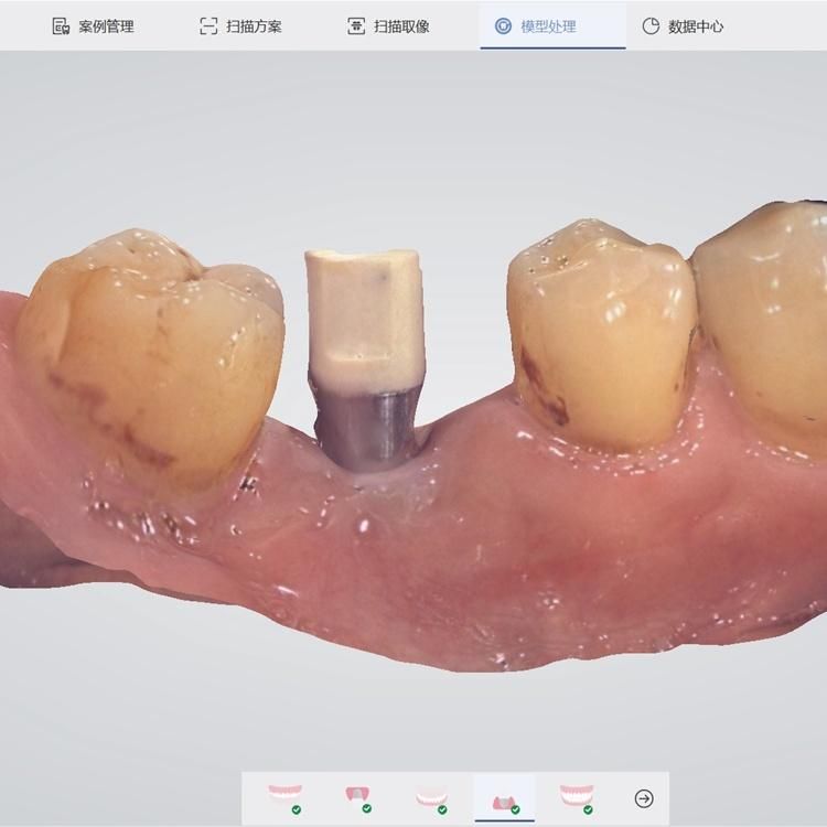 Cheap Price Panda P2 3D Dental Digital Intraoral Scanner