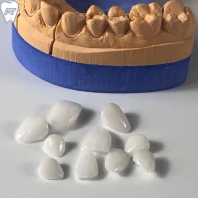 No Preparation Ultrathin Veneers Made in China Dental Lab