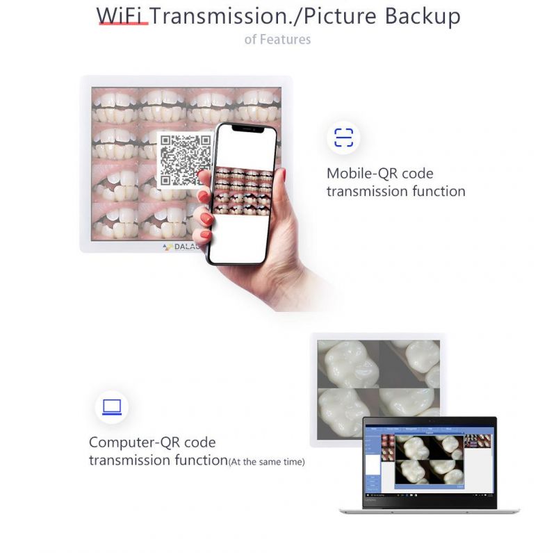 17inch LCD Monitor 10 Megapixels High Definition Dental Digital Camera Viewer Intraoral Camera Endoscrope with Multimedia and WiFi Function