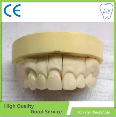 Hot Sale Zirconia Crown Made From China Dental Lab with Aesthetic and Natural Looking