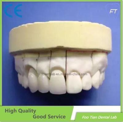 Factory Price Zirconium Crown Custom Dental Material Lab Implant Dental Lab Full Contour Without Porcelain