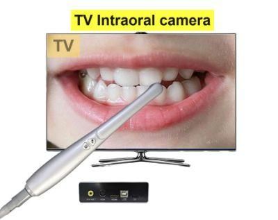 1080P Portable TV Oral Dental Camera Tiny Control Box SD Card Storage