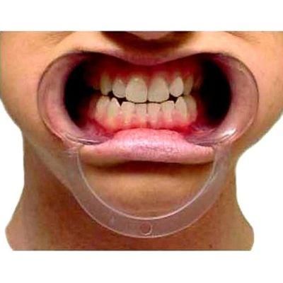 C Shape Opening Device Orthodonic Plastic Mouth Lip Opener