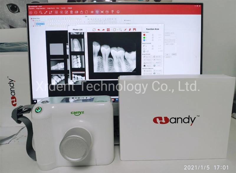 Touch Screen Handheld Dental X-ray Machine with Japan Toshiba Tube