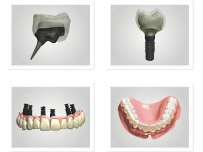 Dental CAD Design