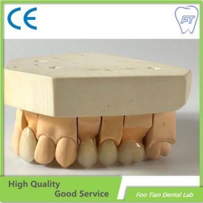 Good Service Removable Metal Denture Cast Partial Framework Dental