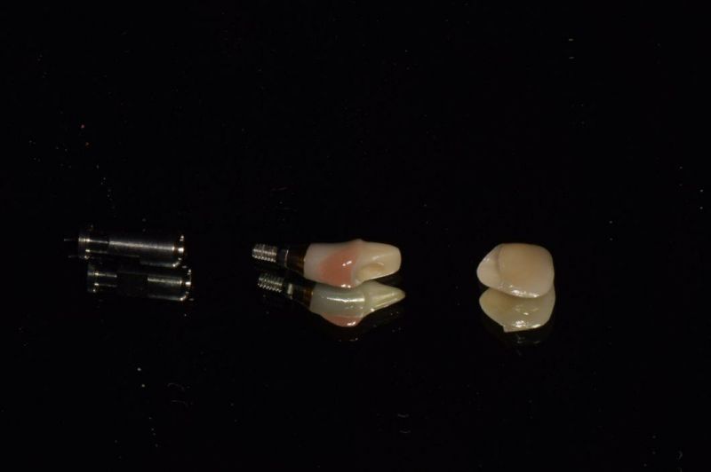 Dental Material Lab Implant Dental Custom Abutments Compatible with Nobel, Straumnn, Dentium, Mis, Astra Tech, Zimmer, Dio, Osstem