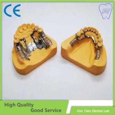 Orthodontic Products Dental Material Supplies CAD Cam Dental Implant Crown Made in China Dental Lab