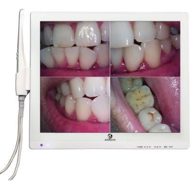 Cost-Effective Dental Intraoral Camera From Factory Supporting WiFi Image Share