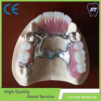 Dental Cobalt Chrome Casting Framework Denture