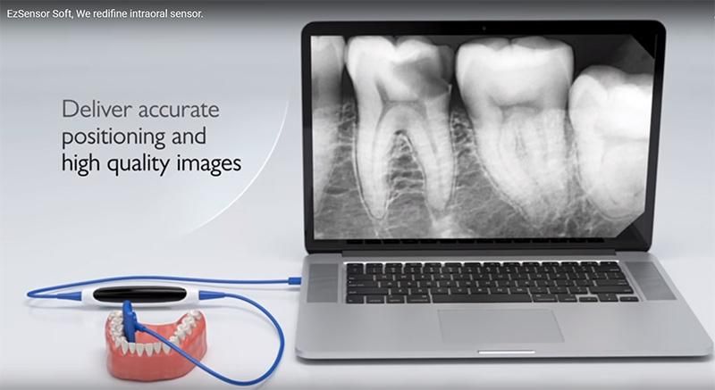 Dental Sensor Korea Ez Sensor USB Digital Dental X-ray Sensor