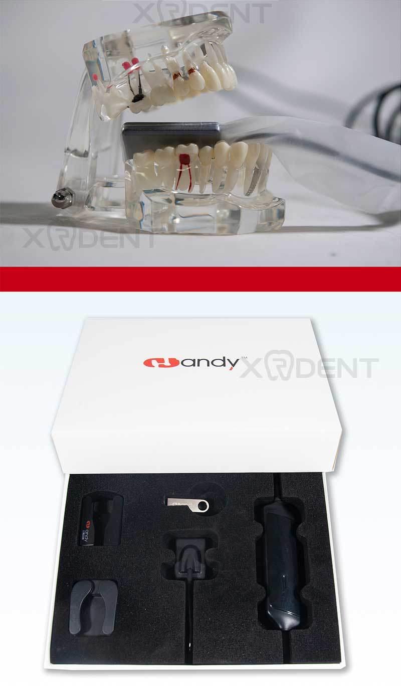 Rvg High Resolution Dental Digital X-ray Sensor China Dentistry Equipment