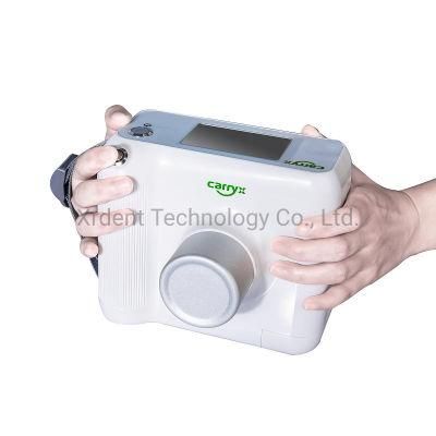 Factory Price Best Medical Digital Portable Dental X Ray Machine for Sale