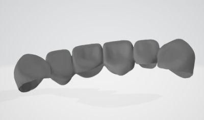 Dental 3shape Exocad Software Smile Design Service From China