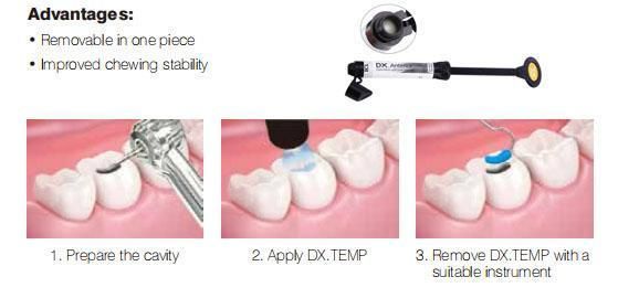Universal Light Cure Composite Filling Material Dental Composite Resin