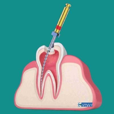 Good Quality Root Canal Files, with Special Laser Marking, Easy to Identify The File Model