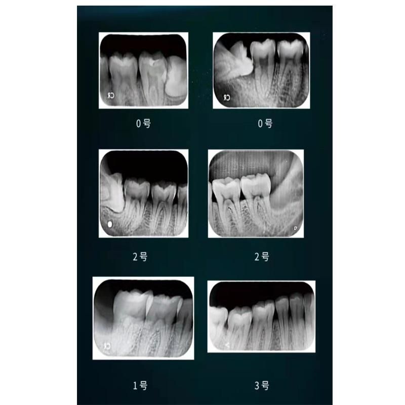 Dental Phosphor Plates Scanner Machine