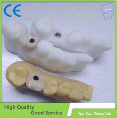 Good Service Denture Zirconia Crown with High Aesthetic and Natural Customized