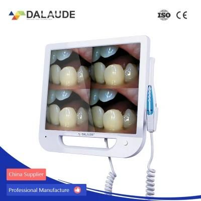 Functional CE Cetificated Intraoral Camera VGA Connection Available on Any Monitor