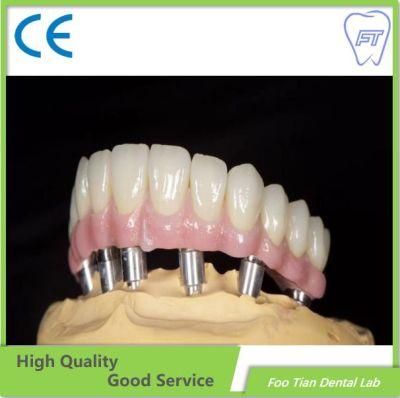 Foo Tian Brand Manufacture Zirconium Crown Custom Dental Material Lab Implant Dental Lab Full Contour Without Porcelain